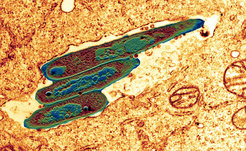 Bacteria of the weakened tuberculosis vaccine strain (BCG) inside a macrophage, a phagocyte of the immune system.