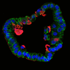 Cross section of a fallopian organoid infected with Chlamydia (red) under the microscope.