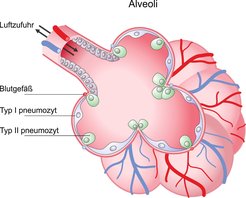 Grafische Darstellung eines Lungenbläschens. An den Typ II Pneumozyten dockt das Sars-CoV-2-Virus an.
