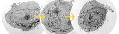 Drei Entwicklungsstadien des neutrophilenartigen Zelltyps PLB-985: Um ihre Verteidigungsmechanismen zu entwickeln, durchlaufen Neutrophile diesen Entwicklungsprozess, der Granulopoese genannt wird. Transmissionselektronenmikroskop-Bilder von Volker Brinkmann.