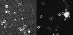 Healthy cells from a human lung (left) and lung cells infected with the SARS-CoV-2 variant 501Y.V2 (right).