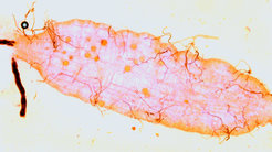 Mosquito gut with about 20 small, round malaria parasites