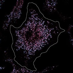 In dieser Zelle wurde Toll-like Rezeptor 7 pink angefärbt, um ihre Anzahl und Lage unter dem Mikroskop zu analysieren. Die Zelle ist gesund und die Anzahl der Toll-like Rezeptoren normal. Anders gestaltet es sich bei Immunzellen von Lupus-Patienten, die eine deutlich erhöhte Zahl von Rezeptoren aufweisen. Dadurch wird körpereigenes Erbgut erkannt und die chronischen Entzündungen des Lupus ausgelöst.