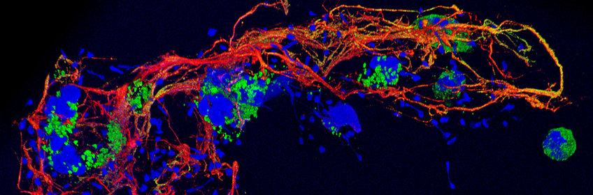 Chromatin and immunity