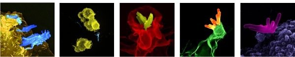 Stefan H. E. Kaufmann - Immunology Stefan H. E. Kaufmann - Immunology